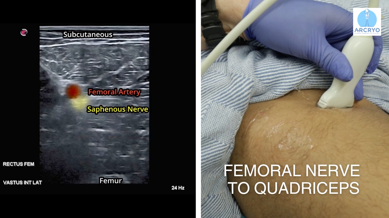 Course 4 | Hip and Knee Region