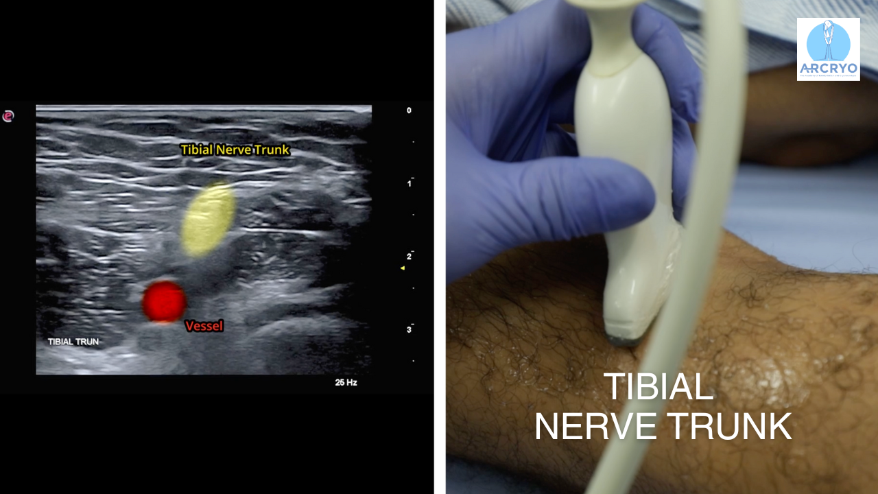 Course 5 | Ankle and Foot Region