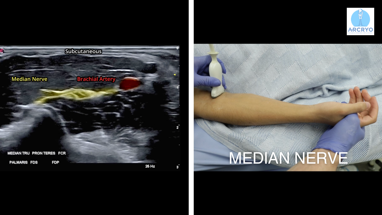 Course 3 | Wrist and Fingers Region